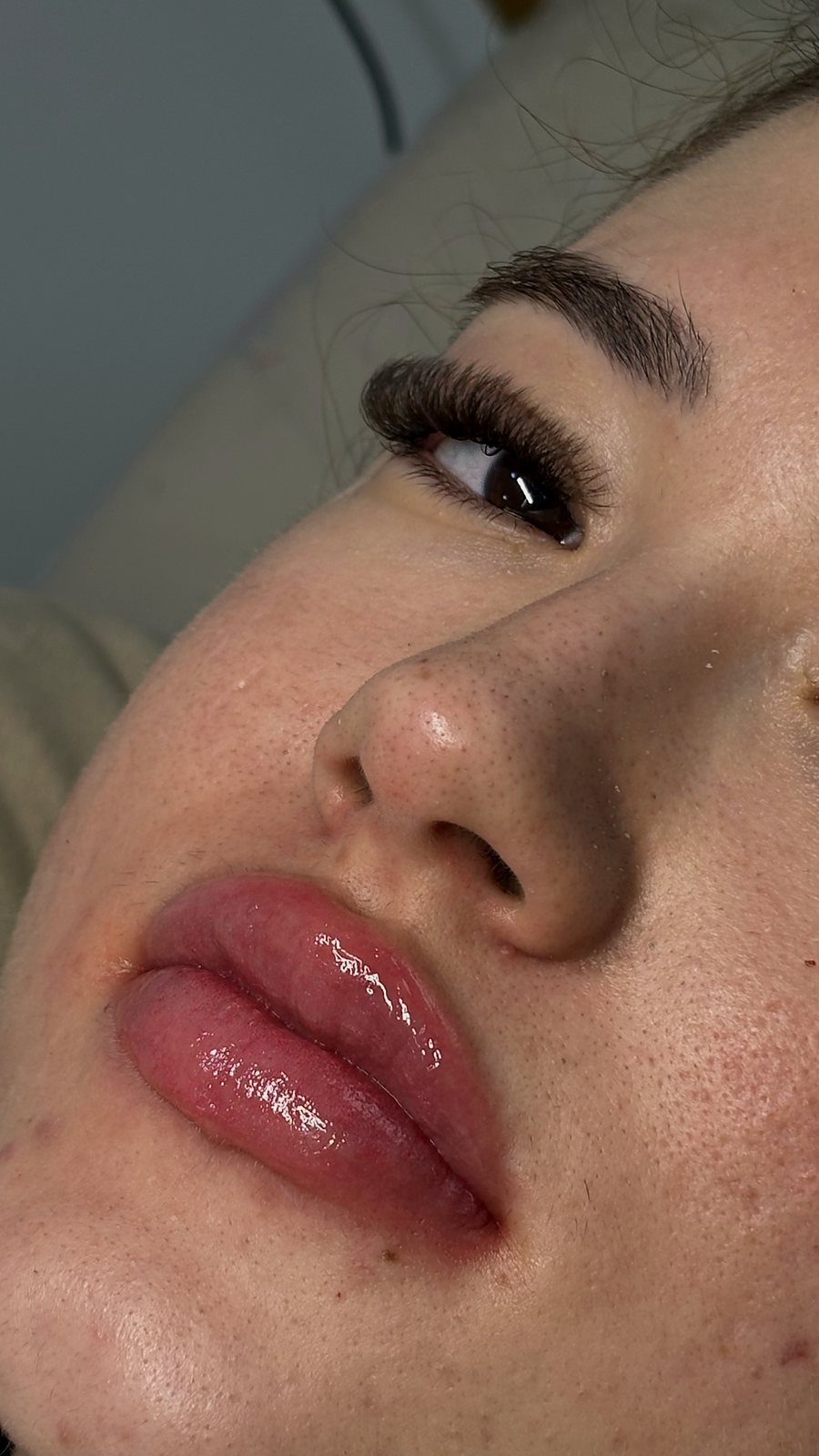 Lábios hidratados e com brilho após o Hidra Gloss Lips